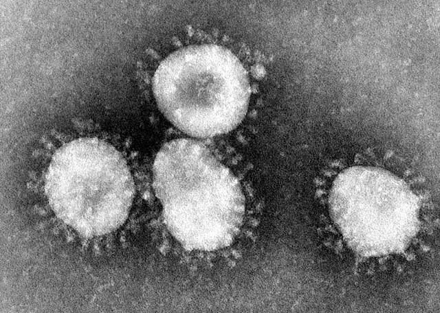 Virus Covid-19 4